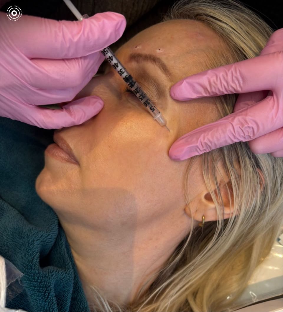 Treatment being carried out at A&A Medical Aesthetics